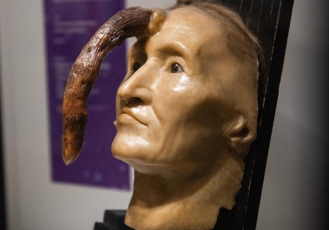 modello di cera di donna con crescita sulla fronte