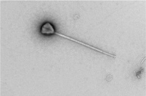 micrografia di virus con coda lunga