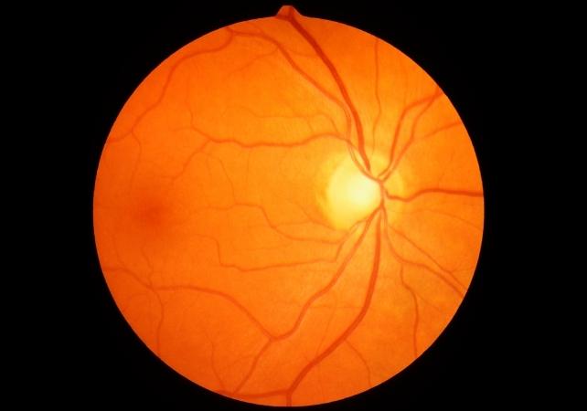 immagine della retina