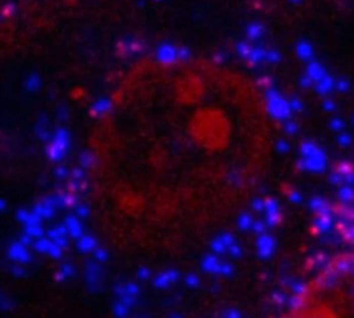 Microplastiche blu evidenziate stipate in una cellula ossea
