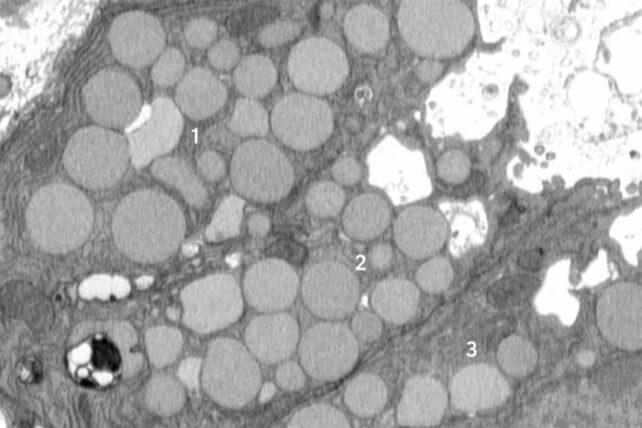 Le cellule danneggiate possono 'vomitare' rifiuti per favorire la guarigione, secondo uno studio