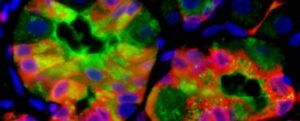 Le cellule danneggiate possono 'vomitare' rifiuti per favorire la guarigione, secondo uno studio