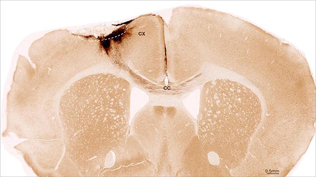 Sezione trasversale del cervello di un topo.