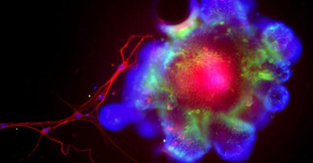 L'alcol potrebbe aiutare i batteri intestinali a 'fuoriuscire' nel fegato e causare danni