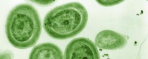 immagine microscopica di cianobatteri