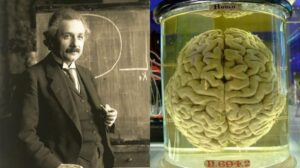 La nuova tecnica di mappatura RNA della Cina potrebbe potenzialmente analizzare il cervello preservato di Einstein