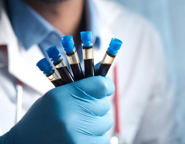 Primo piano di una persona che tiene campioni di analisi del sangue