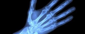 Illustrazione a raggi X di una mano blu luminosa