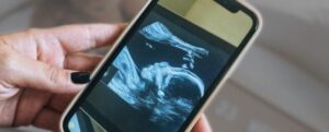 ecografia di un bambino su un telefono