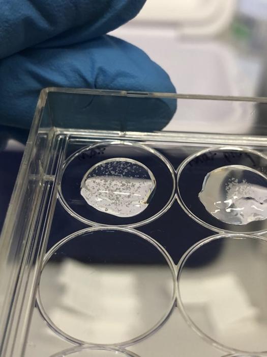 Una mano guantata che tiene un vassoio di plastica trasparente contenente pozzetti di gel con piccole macchie al suo interno
