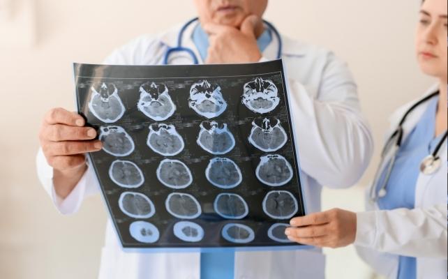 scansione MRI