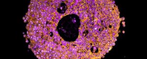 immagine al microscopio di cellule di organoidi placentari