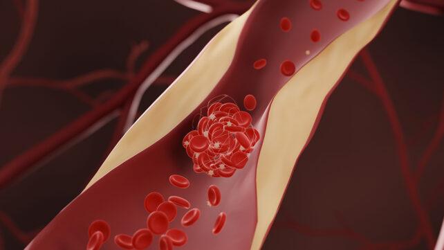 BloodVessels-1-642x361-1.jpg