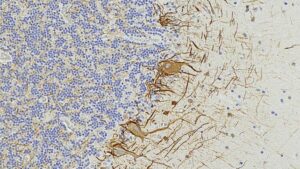 Illustrazione delle cellule cerebrali