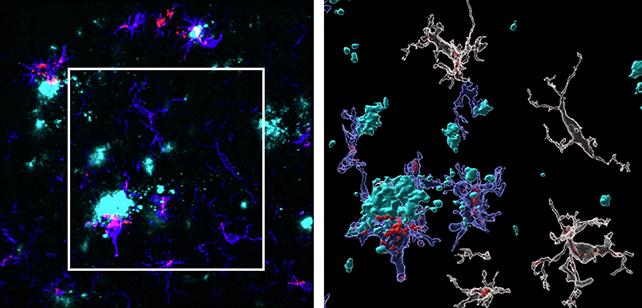 analisi delle cellule cerebrali