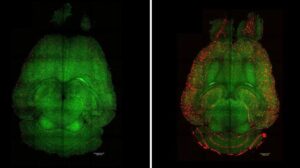 Il switch nanotech inverte l Alzheimer nei topi ripristinando la barriera protettiva del cervello