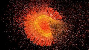 immagine computer HIV
