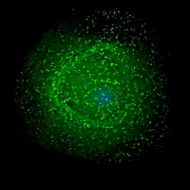 immagine microscopica di HIV sulla superficie di un macrofago infetto