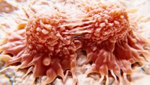 Nuovo trattamento innovativo uccide in modo sicuro le cellule cancerose con la luce
