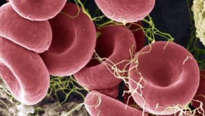 Un nuovo test del sangue può davvero rilevare la ME/CFS? Ecco cosa sappiamo