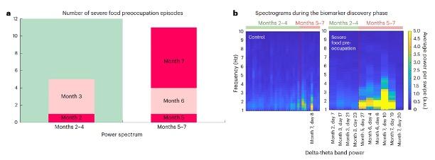 Due grafici che mostrano l'attività cerebrale durante i momenti di preoccupazione per il cibo.
