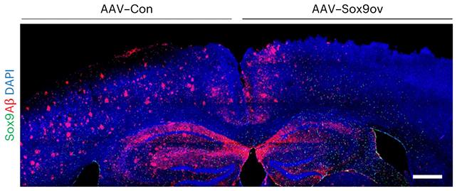 Scansione del cervello del topo