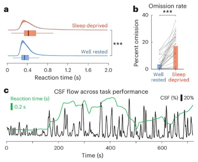 Grafici di scansione cerebrale
