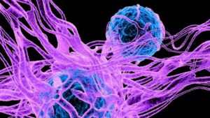 Illustrazione di cellule cancerose (blu) circondate da reti sanguigne (viola)