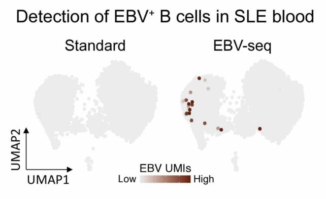 Cellula B EBV