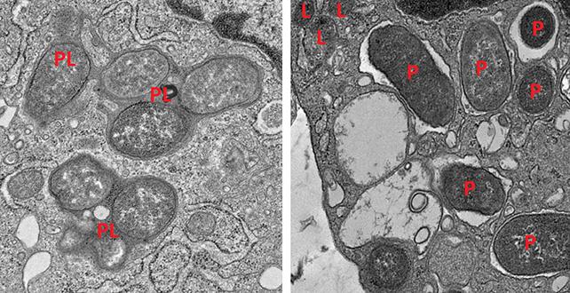 Attività dei macrofagi nell'intestino