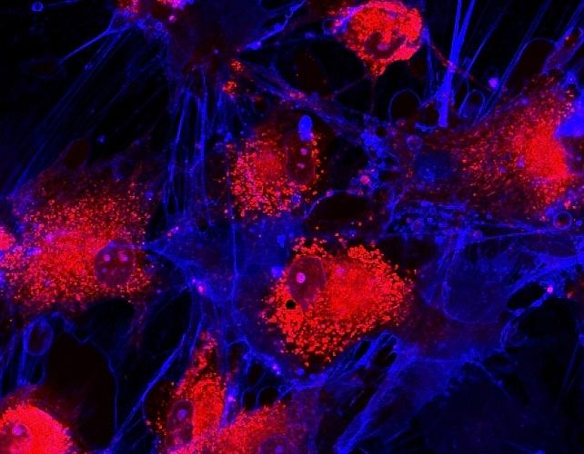 Cellule rosse con proiezioni blu simili a filamenti che le circondano