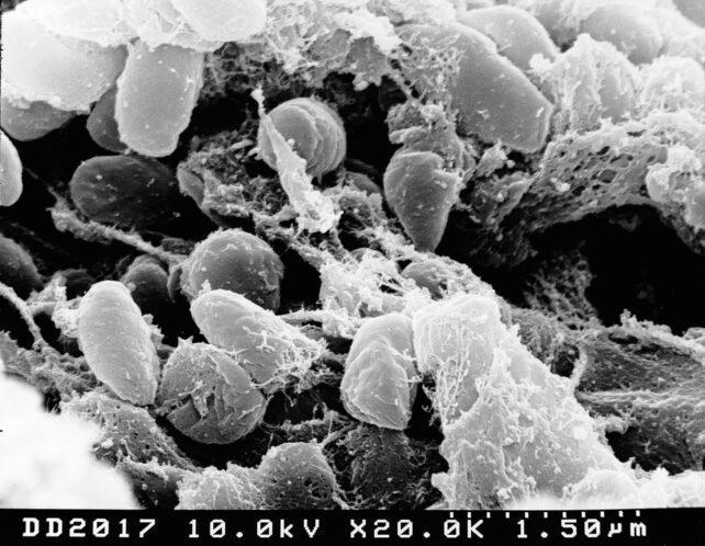 Micrografia elettronica a scansione di batteri Yersinia pestis