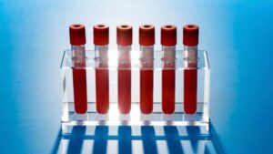 tubi di sangue in un supporto
