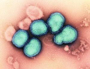 Virus dell'influenza A (H3N2), colorare le immagini al microscopio con le particelle virali circolari che appaiono di colore turchese su uno sfondo rosa