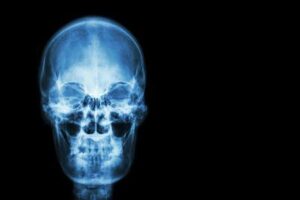 Radiografia della testa