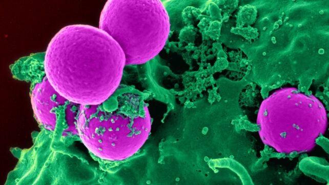 Human_neutrophil_ingesting_MRSA-642x361-1.jpg