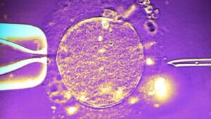 Un ago pronto a iniettare spermatozoi in un ovulo nel trattamento IVF