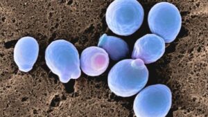 cellule di candida albicans, per illustrare come l'infezione fungina comune stia diventando resistente ai farmaci antifungini