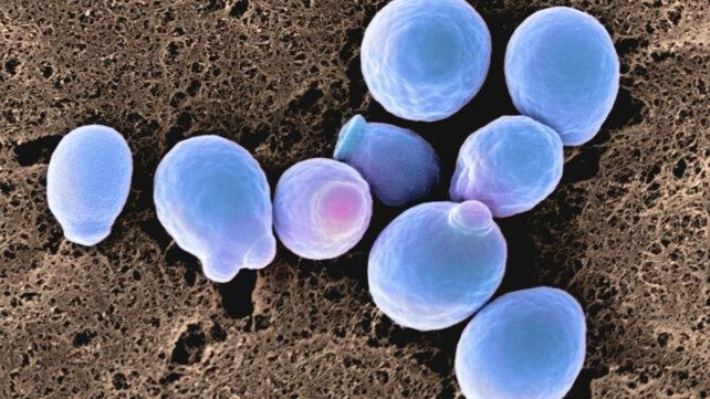 candida_cells_header-642x361-1.jpg