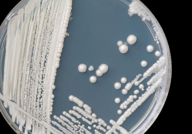 colonie di candida su una piastra di agar