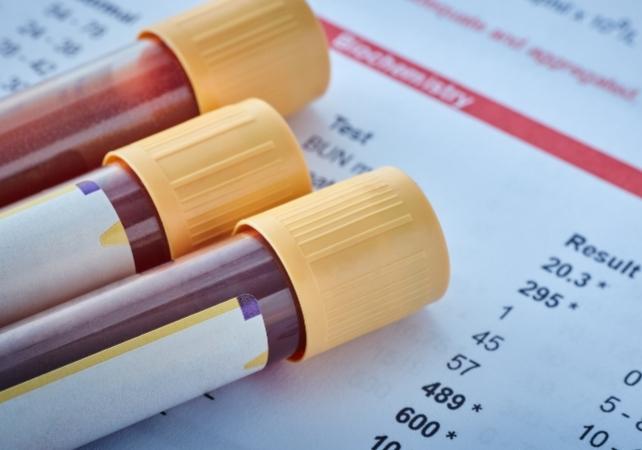 doctor_blood_test_642.jpg