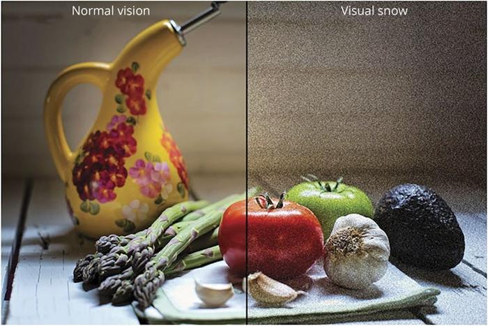 Una collezione di frutta e verdura, metà delle quali è coperta di statico.