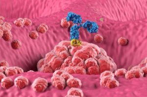 Illustrazione 3D che rappresenta il trattamento con anticorpi monoclonali nel cancro dello stomaco (gastrico)