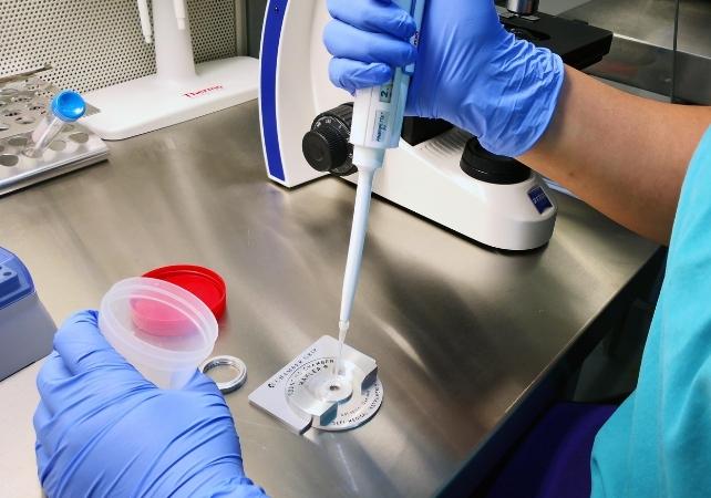 test di laboratorio su un campione di spermatozoi