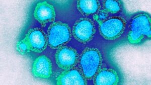 particelle del virus H3N1