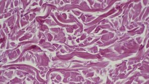 Tessuto connettivo fibroso denso