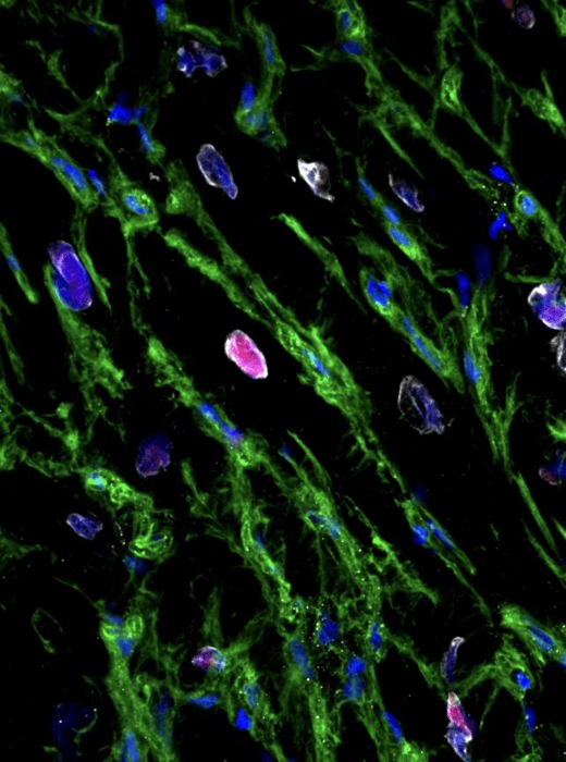 Il tessuto cardiaco umano può rigenerarsi dopo un attacco di cuore, mostra un nuovo studio