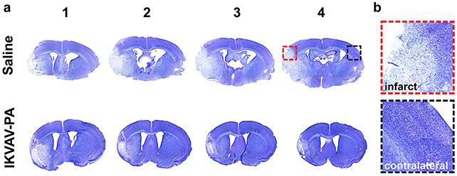 Scansioni del cervello dei topi