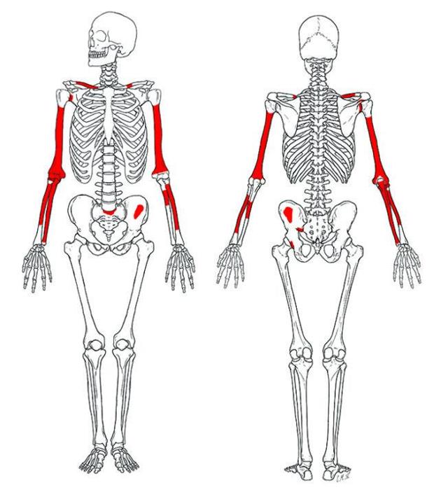 Homo Habilis di 2 milioni di anni fa 