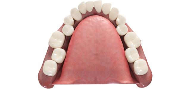 illustrazione denti affollati